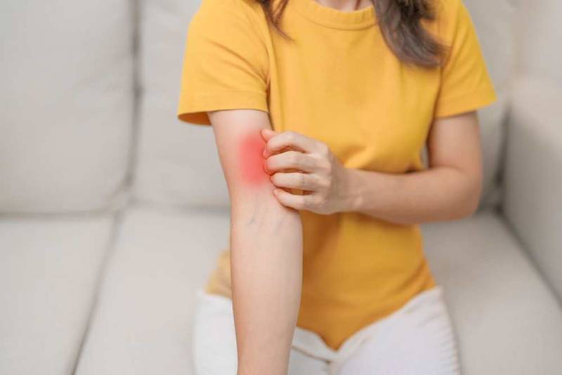 Medical illustration showing inflamed joints, skin rashes, and organ involvement, representing the symptoms and systemic effects of systemic lupus erythematosus (SLE)