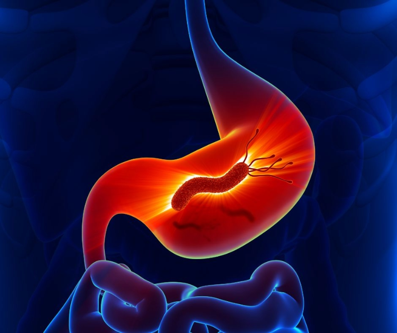 Close-up illustration of a human stomach affected by Helicobacter pylori bacteria, showing inflammation and irritation of the stomach lining.