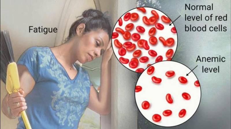 Dizzy and pale? Discover how to treat anemia and boost your iron.