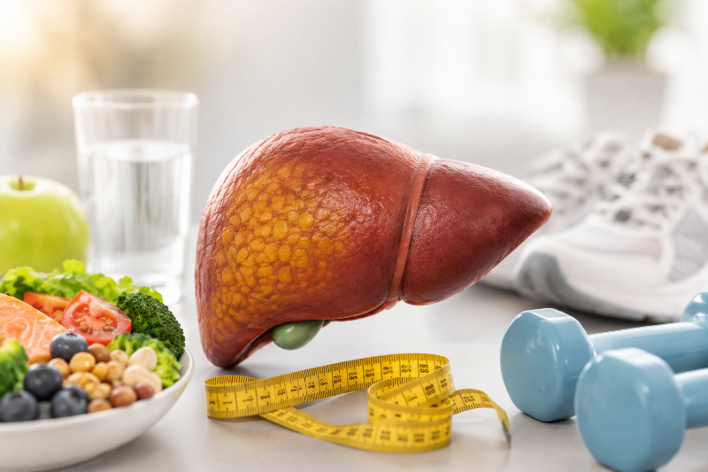 What's the Treatment for Fatty Liver? And Can You Actually Get Rid of It for Good?
