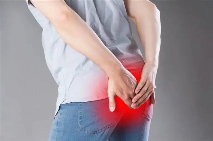 Inflamed pilonidal sinus causing pain and discomfort in the sacrococcygeal area