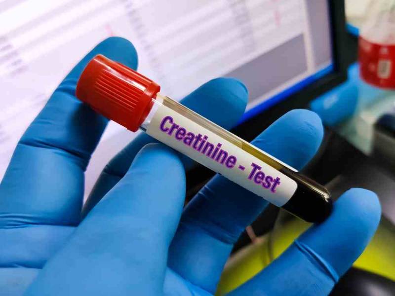 Causes of High Creatinine Levels in the Blood and Its Symptoms
