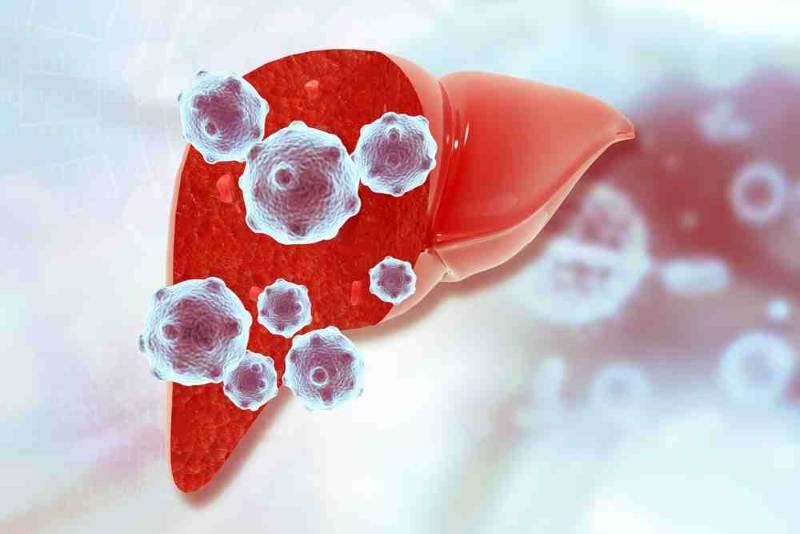 Illustration of Hepatitis A virus affecting the liver