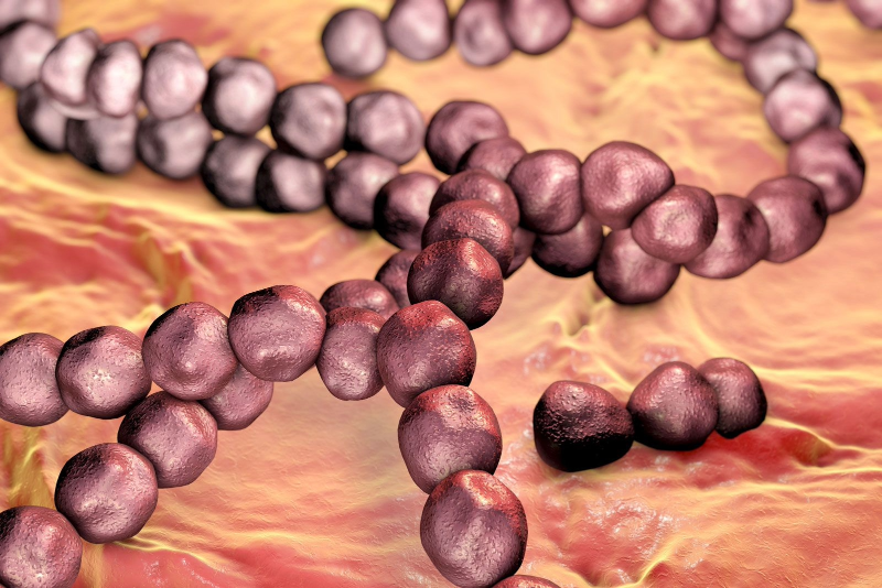 Close-up of a person’s throat showing redness and inflammation typical of strep throat
