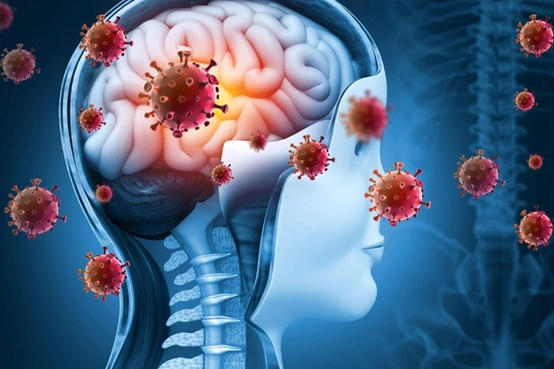 Medical diagram showing meninges inflammation in a patient with meningitis