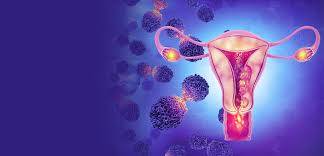 Symptoms of Cervical Cancer and Its Causes in Women