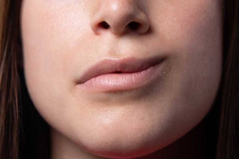 ما هى أعراض التهاب العصب السابع وما علاجه؟