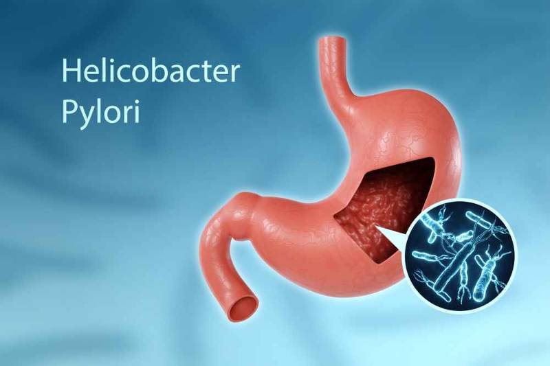 أعراض جرثومة المعدة وعلاجها