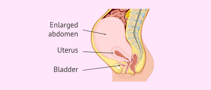 A close-up of a woman gently holding her slightly bloated abdomen, symbolizing the physical symptoms of false pregnancy—such as abdominal swelling and the sensation of being pregnant despite the absence of a fetus.