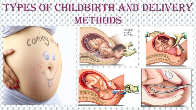 Illustration showing different modes of delivery, including natural vaginal birth, assisted delivery with forceps or vacuum, and cesarean section, highlighting procedures and positions for childbirth