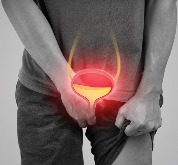 أعراض التهاب البروستاتا وطرق علاجه