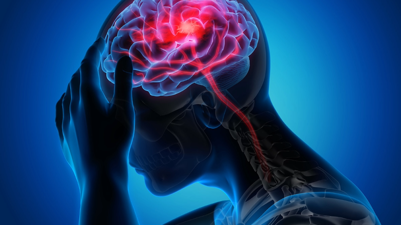 Medical illustration showing a human brain with a blocked blood vessel, representing ischemic stroke, alongside emergency response symbols