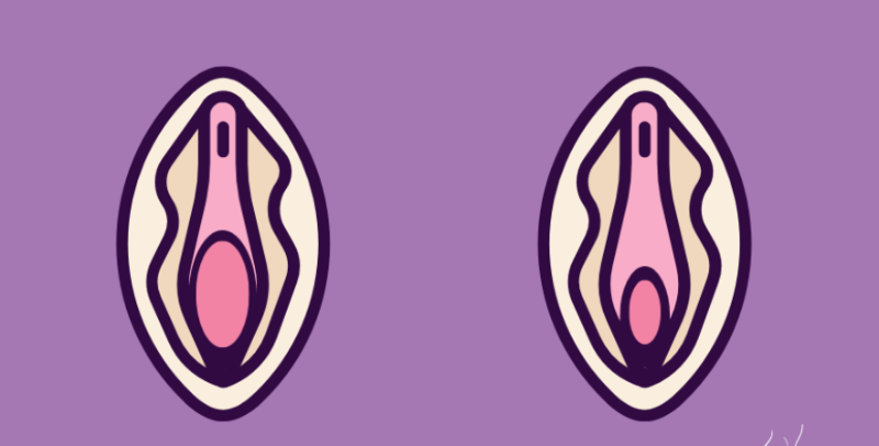 Before-and-after medical illustration showing the vaginal canal with loosening and improved tightness after treatment, highlighting changes in muscle tone and tissue firmness